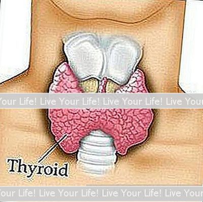 Comment Guérir Votre Thyroïde